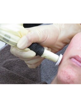 毛穴ケアをしたい