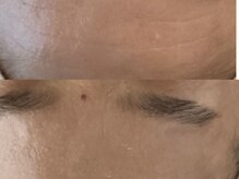 ジョーヌ(JAUNE)/結果を実感できる施術