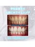 【学割U24】美白ホワイトニング20分×6回￥15,000→￥13,200