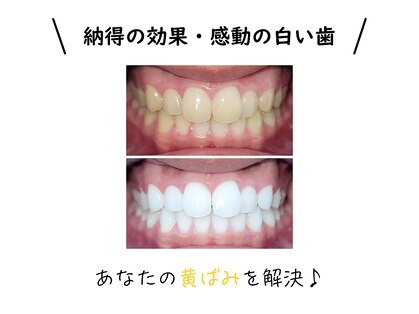 ホワイトニングセンター 広島福山駅前店の写真