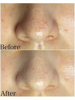 ブラックボックス(BLACK BOX)/20代女性のお客様