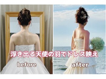 アミクール エステティックサロン(amicoeur)/ブライダルエステで変身