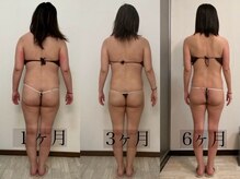 ベル(belle)の雰囲気（【脂肪冷却】短期間で驚き効果！リバウンドのない理想体型）