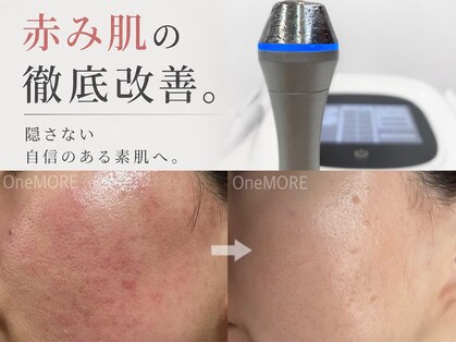 ワンモア(One MORE)の写真
