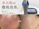 ワンモア(One MORE)の写真