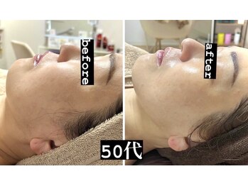 ビーグロッシー(B.glossy)