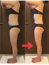 ビープロデュース 尾張旭店(B' PRODUCE)/ プロの手を借りて確実痩身