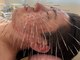 ふじた鍼灸整体院の写真/効果実感◎三重県では希少な《鬼美容鍼》で気になるお肌のお悩み改善！美容鍼が初めての方にもオススメ♪