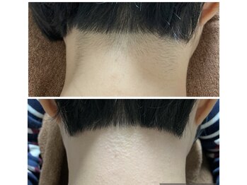 アンビジュ(un bijou)/ショートスタイル WAX脱毛のみ