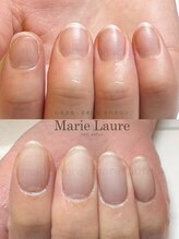 マリーロール 淀屋橋本店(Marie Laure)/自爪育成/深爪矯正/ネイルケア