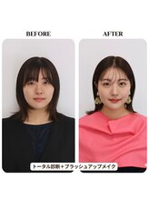 シュアリー(Surely)/トータルコースお客様事例