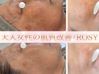 ロージー(ROSY)