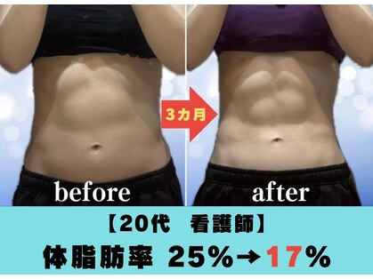 ブルーローズ(BLUE ROSE)の写真