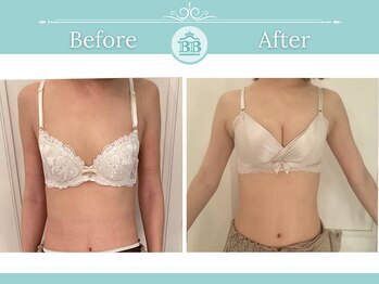 美人バスト 新潟店/ 【バストアップ★育乳】症例