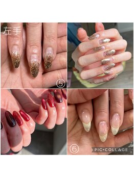 ラモ(RAMO)/ジェルをつけてから半年経過