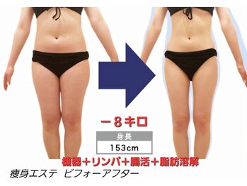 カワカミ 美人塾エステ(kawakami 美人塾エステ)/腸活痩身エステ