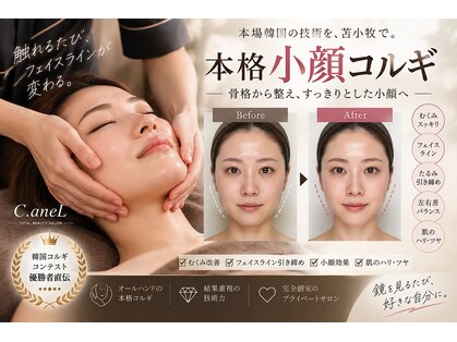 シーアンル(C.aneL)の写真