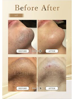 シーアンドコー(C&co.)の写真/メンズのフェイシャル脱毛なら『C&co.』へお任せください！技術力は勿論、デザイン力にも自信あり！