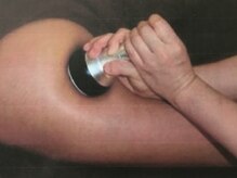 セピア(Sepia)/本気痩せコース