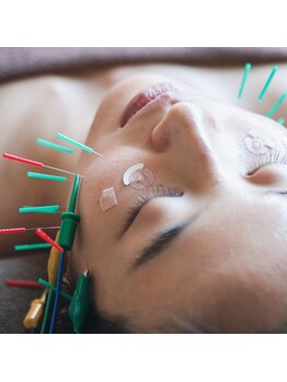 エミット(emit.)/小顔パルス美容鍼