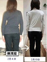 エスコート芦屋サロン/40代　女性　側湾　