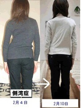 エスコート芦屋サロン/40代 女性 側湾
