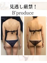 ビープロデュース 亀有店(B’PRODUCE)/Before &after
