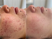 プライベートサロン ラウレア(Laule'a)の雰囲気（貴方に合ったフェイシャルとスキンケアをご提案いたします）