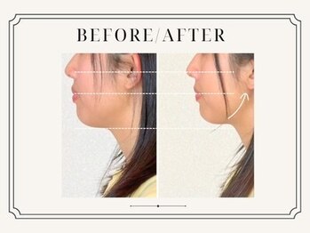 グレース鍼灸院 整骨院 ひたちなか/