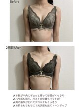 チュラ 大宮店(Chura)/【20代】バストアップ2回目@大宮