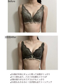 チュラ 大宮店(Chura)/【20代】バストアップ2回目@大宮