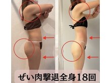 つばめの巣 山科の雰囲気（全身１8回コース【スタイルアップ】お洋服サイズダウン痩身）