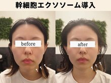 sleep monster｜バクの隠れ家【4/1 NEW OPEN（予定）】/