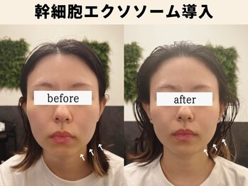 sleep monster|バクの隠れ家【4/1 NEW OPEN(予定)】/