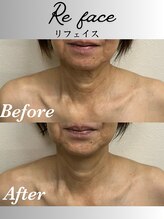 コリー(Kolly)/首も見られてる！？