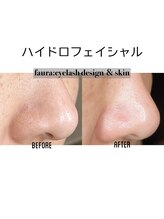ファウラ(faura:)/ハイドロフェイシャル