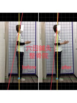 穴田鍼灸整骨院/整体・骨盤・ねこぜ・まき肩矯正