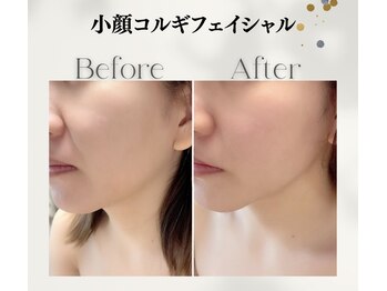ラフォクシー(La.Foxy)/小顔コルギフェイシャル