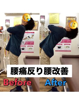 ヒデ整体院(Hide整体院)/猫背矯正骨盤矯正B/A肩こり腰痛