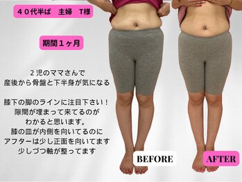 ビジリンヌ/サイズダウン 広島市