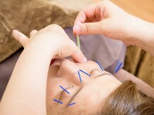 ケイ美容鍼灸整体院(KEI美容鍼灸整体院)/美容鍼