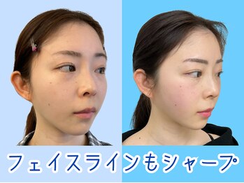 ナチュラルパーフェクトフェイス 新宿/新宿駅小顔矯正専門店/渋谷区