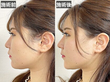 アオヤマ サロン ワイゼット(AOYAMA SALON YZ)の写真