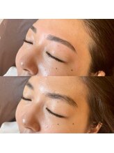 スリーノッツ(THREE KNOTS)/【ハリウッドブロウリフト】