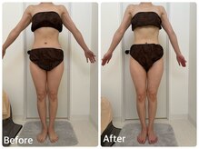 ナビ(NABI)/冷え・浮腫み・肩こり改善！