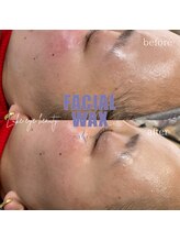 ルークアイビューティ(Luke eye beauty)/フェイシャルワックス