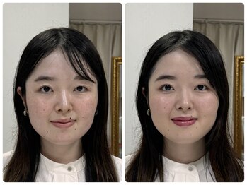 ペールドゥボーテ(Perle de beaute)/お客様before→after