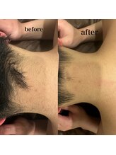 アルティ 福岡大名店(ARTI,)/メンズも襟足追加でできます！