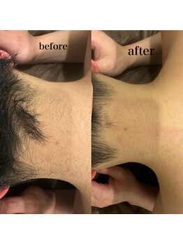 アルティ 福岡大名店(ARTI,)/メンズも襟足追加でできます！