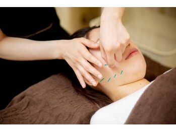 六花鍼灸整骨院 天神店/やすらぎの美容鍼